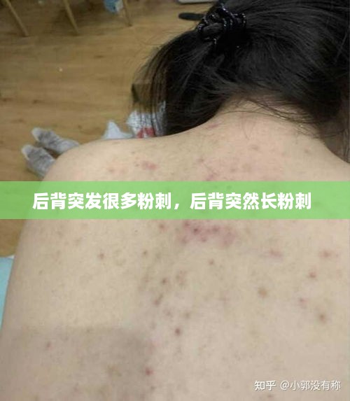 第313页