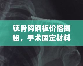 锁骨钩钢板价格揭秘，手术固定材料的费用详解