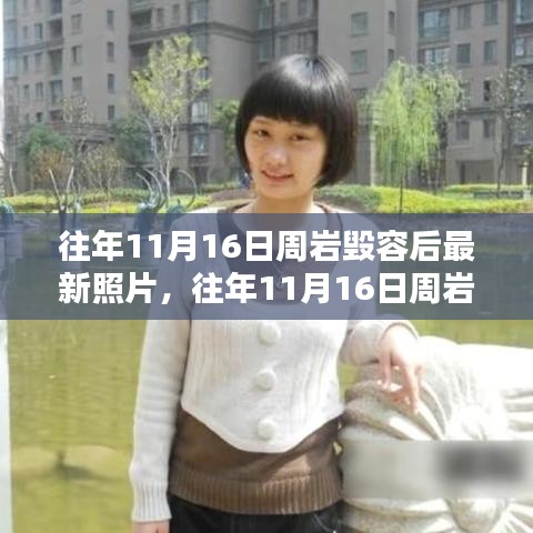 逆境中的坚韧与重生，周岩毁容后最新照片回顾