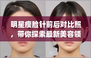 明星瘦脸针前后对比照，带你探索最新美容领域奥秘