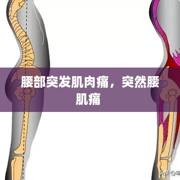 腰部突发肌肉痛，突然腰肌痛 