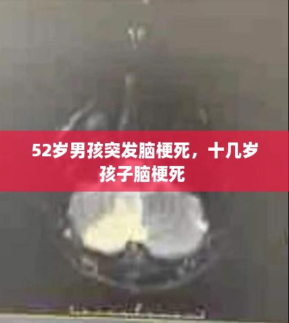 52岁男孩突发脑梗死，十几岁孩子脑梗死 